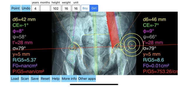 HipBiomechanicsApp(圖8)-速報App