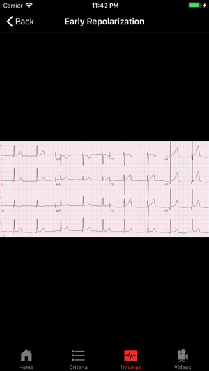 ECGsource(圖2)-速報App