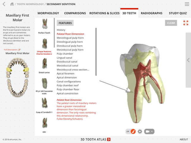 Tooth Atlas 9