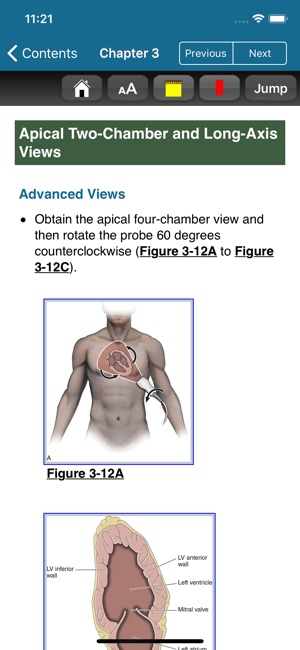 Atlas Emergency Ultrasound, 2E(圖5)-速報App