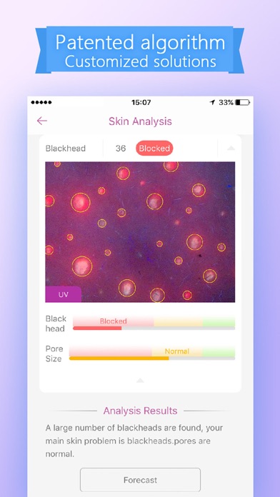 Skin Analyserのおすすめ画像3