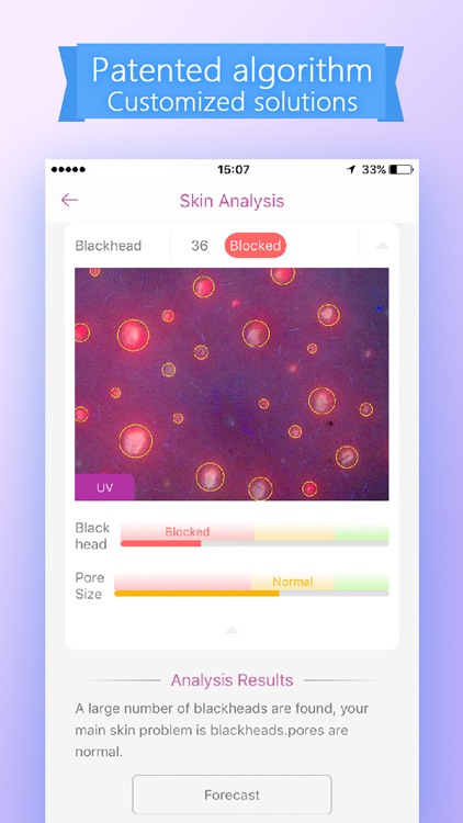 Skin Analyser