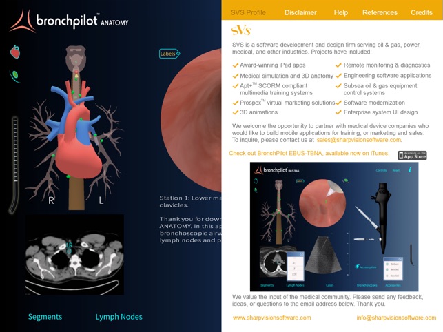 BronchPilot ANATOMY(圖5)-速報App