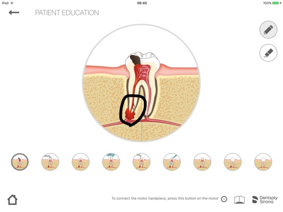 Endo IQ® Appのおすすめ画像5