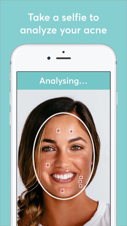 MDacne - Custom Acne Treatment