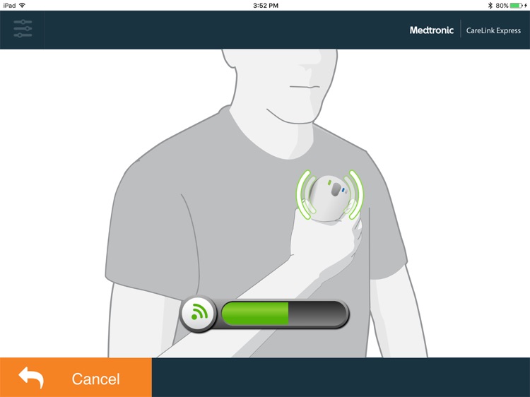 CareLink Express Mobile EU By Medtronic Inc 