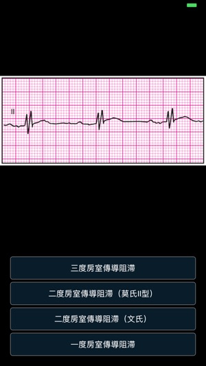 ECG Pro - 海量心電圖案例和診斷詳解(圖6)-速報App