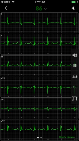 ECG Pro - 海量心電圖案例和診斷詳解(圖3)-速報App