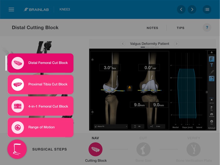 Brainlab KNEE3