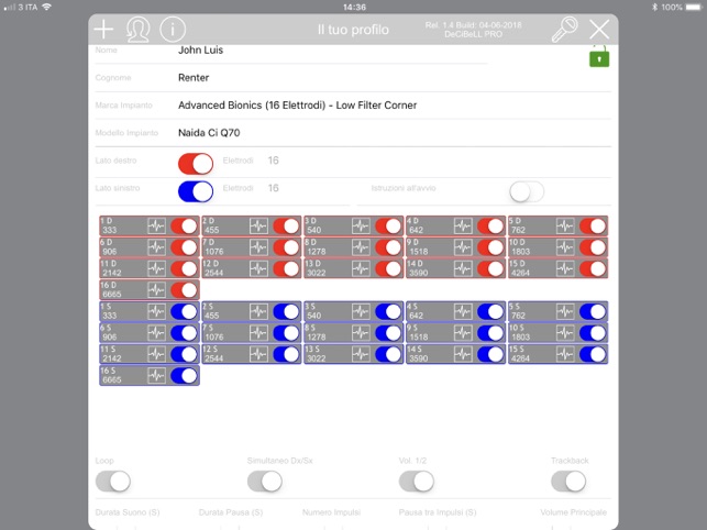 DeCiBeLL X FR(圖2)-速報App