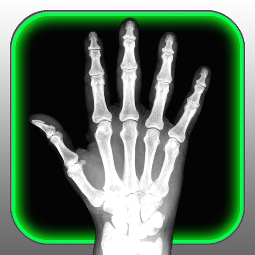 X-Ray Scanner for iPhone iOS App