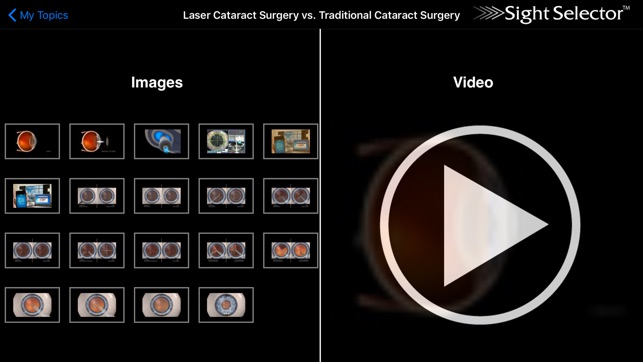 Sight Selector Subscription(圖2)-速報App