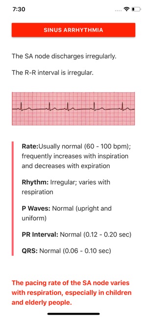 ECG FlashCards(圖1)-速報App