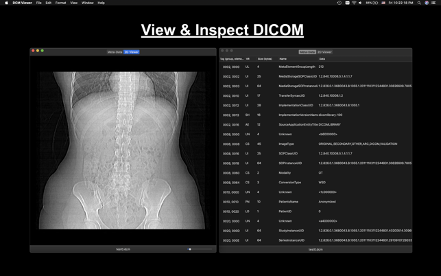 DCM Viewer