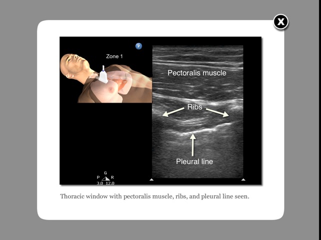 Trauma Ultrasound eBook(圖1)-速報App