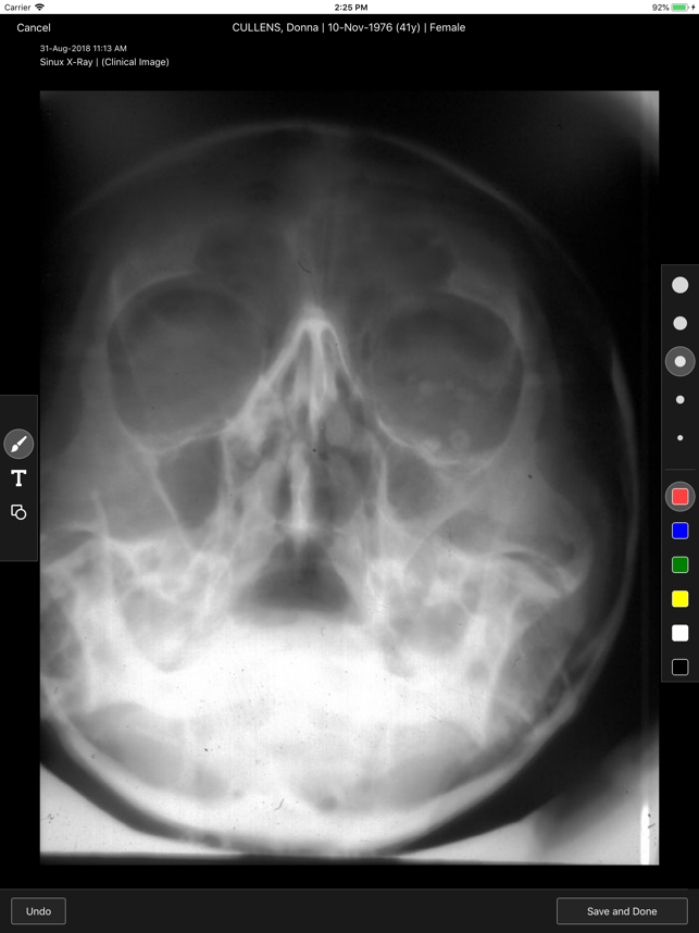 ProEHR Clinical Images(圖4)-速報App