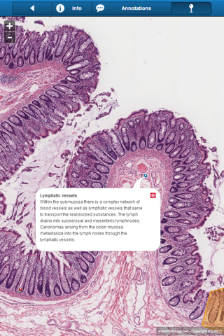 Smart Histology screenshot 4