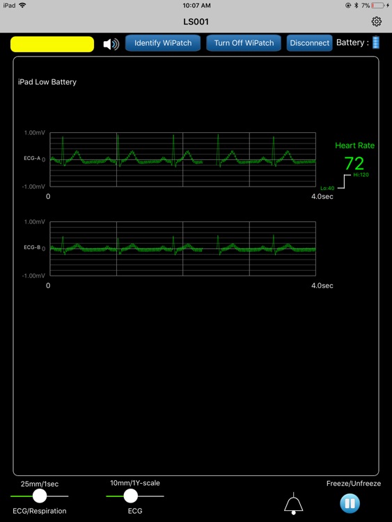 WiPoint Patch Vital Signs