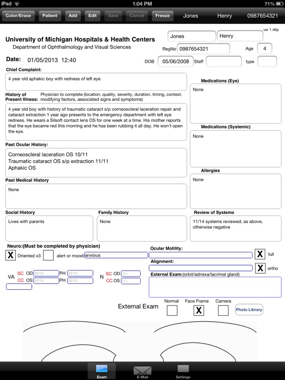 OphthyChart