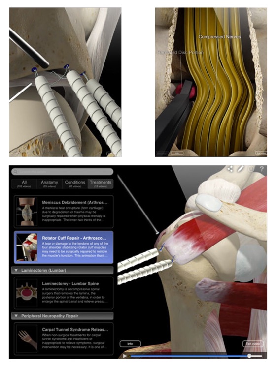 Orthopedic Patient Education screenshot-4