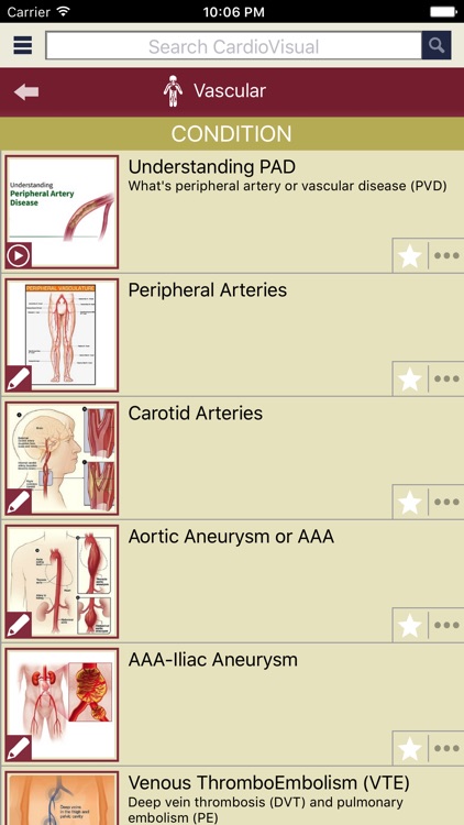 CardioVisual: Heart Health Built by Cardiologists