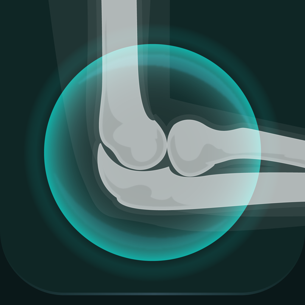 Get Musculoskeletal Pro Consult for iOS, iPhone, iPad Aso Report