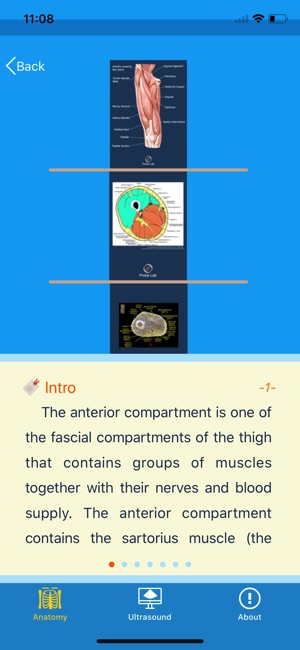 MSK Ultrasound: Thigh(圖2)-速報App