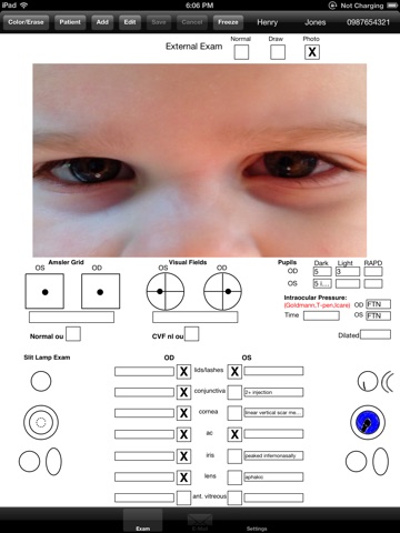 OphthyChart screenshot 3