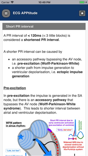 ECG APPtitude(圖2)-速報App