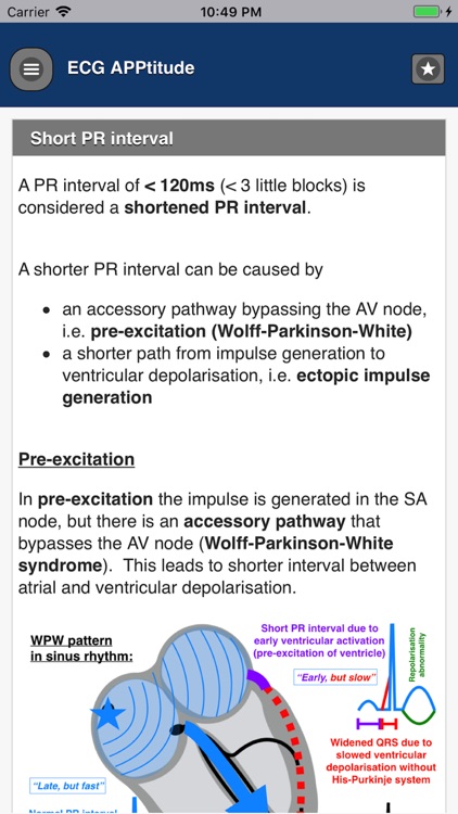 ECG APPtitude
