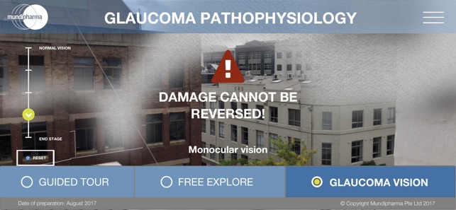 Glaucoma Education(圖6)-速報App