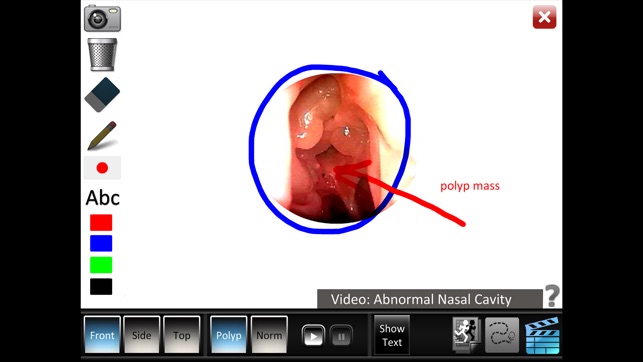 Sinus ID(圖5)-速報App