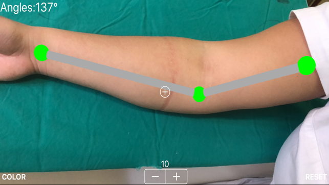 ARorthopaedicGoniometer(圖2)-速報App