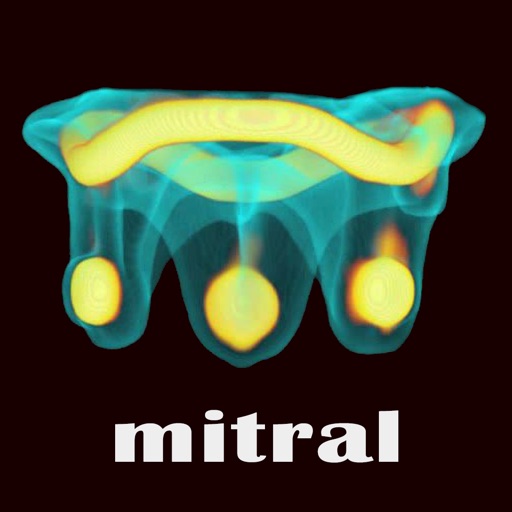 Valve In Valve (Mitral) Icon