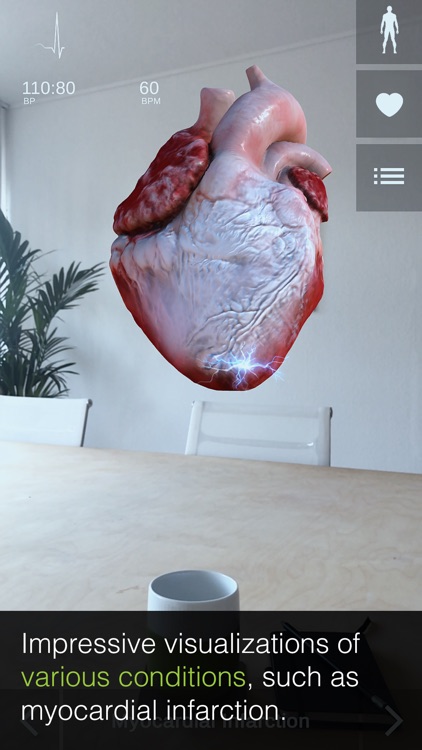 INSIGHT HEART screenshot-5