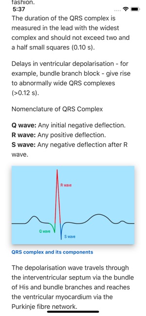 ECG Basics Lite: ECG Made Easy(圖1)-速報App