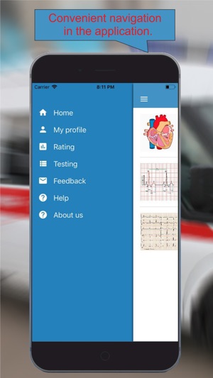 ECG: Interpritation and Tests.(圖4)-速報App