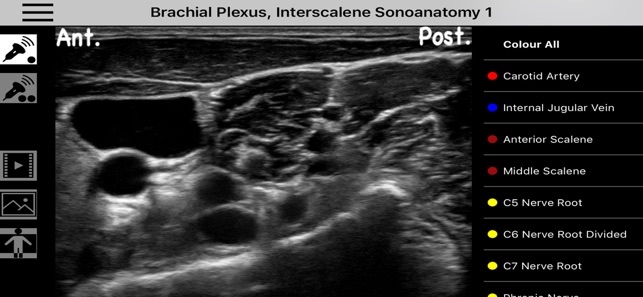 AnSo Anaesthesia Sonoanatomy(圖3)-速報App