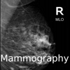 Mammogram Atlas - iPhoneアプリ