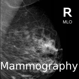 Mammogram Atlas