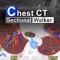 Chest CT Sectional Wa...