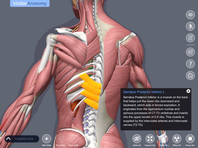 Visible Anatomy(圖1)-速報App