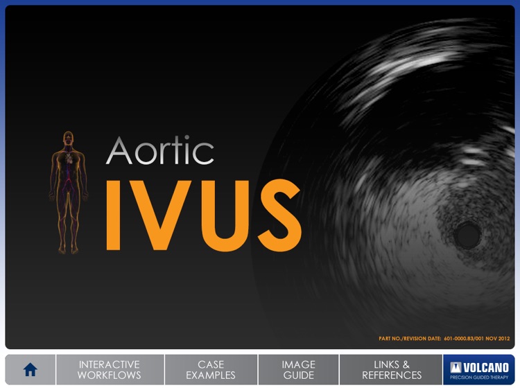 Aortic IVUS