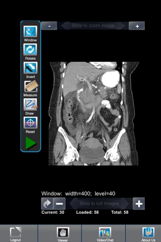 Advanced Radiology Connect screenshot 3