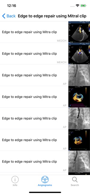 CARDIO3® Interventional Atlas(圖3)-速報App