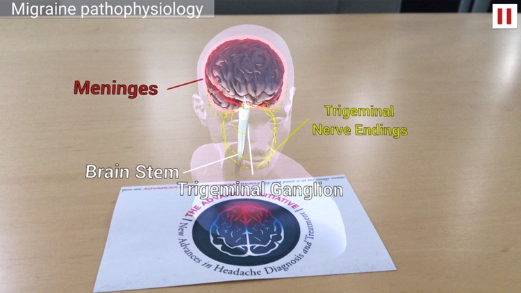 ADVANCES Migraine AR