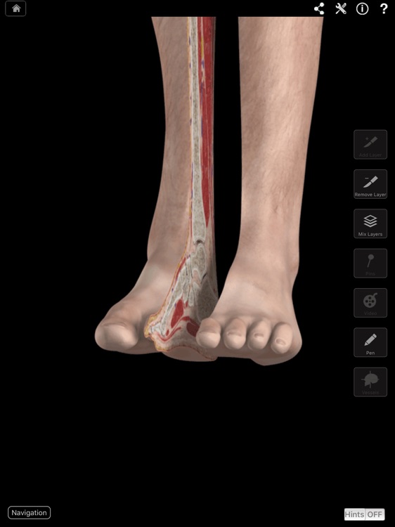 Ankle & Foot Pro III for iPad screenshot-0