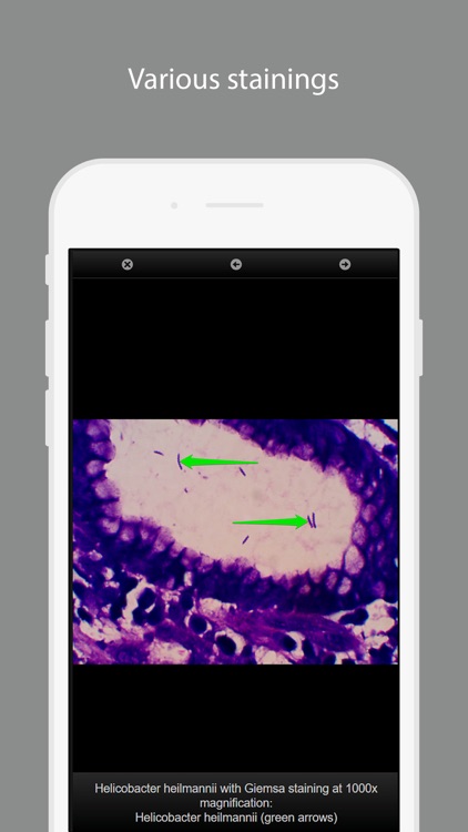 Bacterial Infections screenshot-3