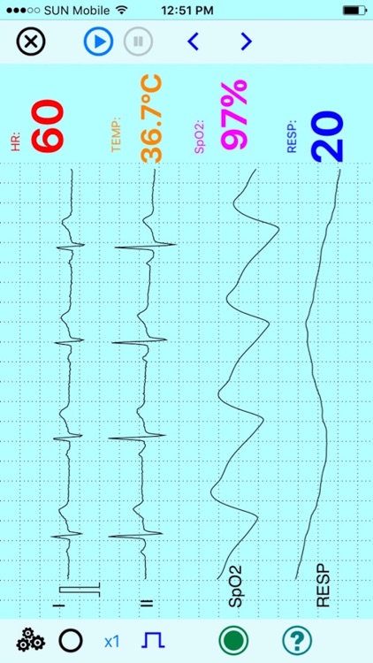 UltraLS   ECG SpO2 TEMP