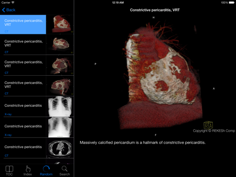 Atlas of Radiological Images screenshot 3